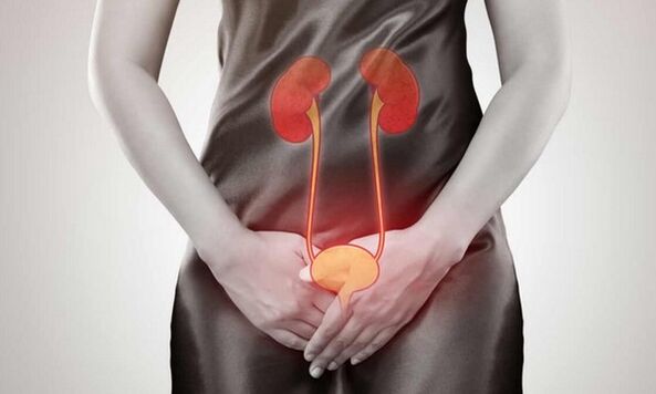 Reasons and treatment of cystitis in women